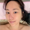 (주)힐링바이오 | 대구 달서구 피부관리 화이팅바디앤스킨 1년만에 바이오필링 받은 후기