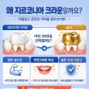 이스타치과기공소 이미지