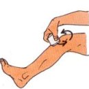 아이싱 이미지