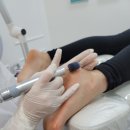 레푸스MS 이미지