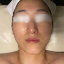 힐링비움 | 의정부 웨딩관리 어디가 좋을까? 예신관리 비움에스테틱 리얼 후기