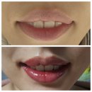 오늘모해요 | 의정부 입술퍼스널디자인시술ㅣ오늘모해요 2일차후기