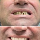 광덕안정치과의원 청량리점 | 치아가 사라진 자리에 남는 선택 임플란트를 이해하는 다른 시선