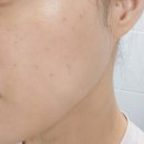 (주)탐케어코리아 | 래디언솜 컨센트레이트 첫 사용 후기 눈가 목 집중케어