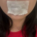 순마음의원 | 선릉 누브의원 부원장 1cc 입술필러 솔직후기