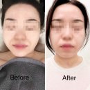 미가코리아 | 송파 경락 가인미가 잠실새내 얼굴경락 프리미엄 관리 후기