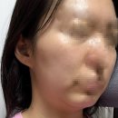 [송파구/문정동]문정 경락ㅣ결이고은 작은얼굴관리받고 온 후기! 결이고은 문정역점(+실제 비교 사진)