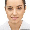 청담아이(i)성형외과의원 | '의정부 성형외과전문의'가 말하는 안면거상 성형외과 선택법