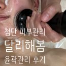 위드미광주첨단점 | 광주 첨단 윤곽관리 달리해봄 20대 후반, 무너진 턱선 심폐소생술! 미레브(Mirev) 리프팅 솔직...