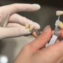 지원치과 기공소 이미지