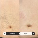 미우대구피우다뷰티 | 대구 왁싱 미우 슈가사용 브라질리언왁싱