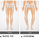 19. (자연의 선택) 인류의 진화는 끝났는가? 근육질의 유목민과 O다리를 가진 사색가 이미지