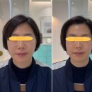 김해장유에스테틱, 얼굴윤곽관리 잘하는곳_에스테티아 김해점