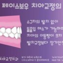 보우치과 네이버블로그