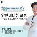 눈높이성형외과의원 | 강동안면비대칭교정, 안면비대칭 실제 교정 후기 케이스 해설