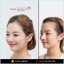 윤헤어라인의원