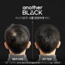 아인뷰티의원 이미지