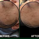 오닉스스킨테라피 이미지