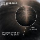 이엔뷰티 | 이엔뷰티 군산두피관리