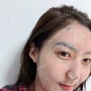 경기도 수원시 팔달구 효원로 269 (인계동) | 수원 인계동 피부과 피코슈어토닝 후기와 효과