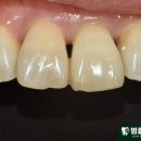 범플란트치과의원 이미지