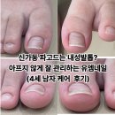 네일하는남자 | 신가동 파고드는 내성발톱 케어 잘 하는 유엠네일 (4세 남자 아이 케어 후기)