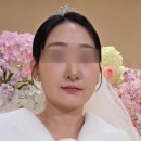 엑스(X) | 결혼식 직전 예신관리로 [제네오X 가격/효과] 제네오엑스 후기!