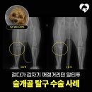 힘찬동물병원 | 김해24시동물병원｜걷다가 갑자기 뒷다리를 들던 말티푸, 슬개골 탈구 수술 후 자연스러운 보행을...
