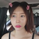 부산 리쥬란 쥬베룩 4cc 리쥬베룩 3주차 연산동 피부과 솔직 후기