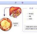 간암 초기 증상과 가려움증 이미지