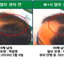 에스엠알두피탈모전문