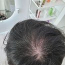 양덕동119 | 양덕동미용실 MH헤어 두피관리 받고 머리결이 달라진 후기