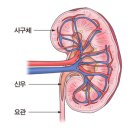 사구체신염[Glomerulonephritis] 신장비뇨기질환 이미지