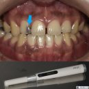 서울유플란트치과의원 이미지