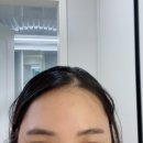 신촌로73번길 | 좁쌀여드름 효과에 좋은 지루샵 세라케어 울트라스킨 후기 얼굴 이마 오돌토돌 주사 피부염