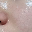 유나메디 네이버블로그