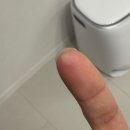 24시약국 | 🔥 글루건 화상, 한밤중 24시 약국에서 찾은 해결책 ‘아즈렌 연고’ 후기