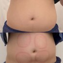 흐르는결 | 야당 복부관리 에스테틱 웰니스결 찐 후기 주목!