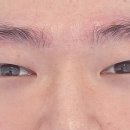 애드브로우