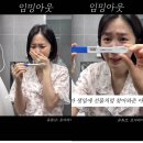 초아