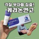 코끼리온누리약국 | 동아 케라논 연고 뒤꿈치 각질 연고, 우레아만으론 부족할때 (살리실산+우레아/모공각화증/건선/각화형...
