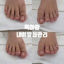 화인크리닝 | 출산 준비로 시작된 발톱 인연! 김**님의 내성발톱 스케일링 &amp; 정기 관리