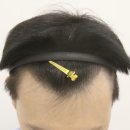 부산 맘모스헤어라인의원 이미지