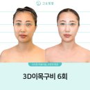 이목구비화장품 | 대구경락 고운빛깔에스테틱대구점 1인실에서 받은 3D이목구비 솔직 후기