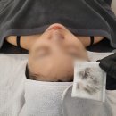 [후기] 전주 중화산동 피부관리 The가꾸다 : 모공스케일링만 받았는데 애기피부로 변신♥