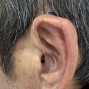 울산독일보청기 | 울산보청기 정부지원 보청기 지원금 안내 시그니아 독일보청기 울산북구센터