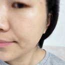 유넬 | 속건조 잡고 피부장벽강화 유넬28 PRDN크림 리얼후기