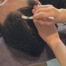 계룡로(유성온천역-만년교) | 봉명동두피관리 모바이오 대전유성점 두피케어 후기 [대전탈모관리]