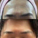 개봉1동 주민센터 | 개봉동 리프팅관리, 남자친구 리프팅 케어 후기💆‍♂️