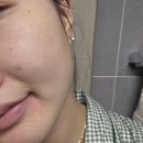 메디영솔루션 | 수분토너 찾다가 아쿠아미노 버블토너로 기초공사토너 시작했어요 진정 보습 각질 역할을 한 번에